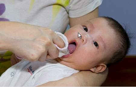Có nên nhể nanh sữa cho trẻ sơ sinh?
