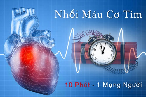 Câu hỏi 40: Dấu hiệu nào phải chú ý là có thể bị Nhồi máu cơ tim?